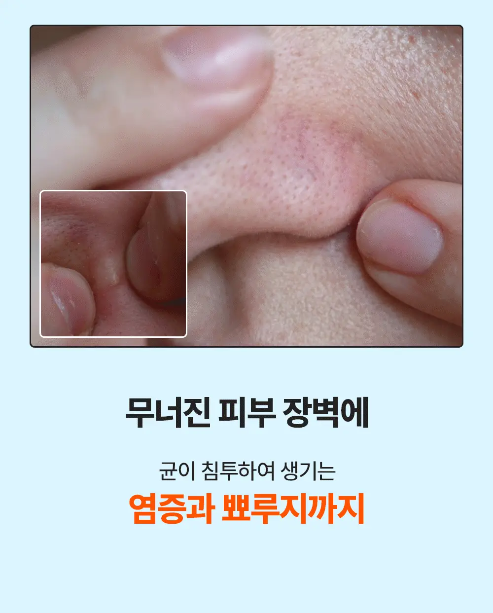 [단독기획] 런드리유 클린 포어 리퀴드 울트라 피지연화제 기획 (+피지전용화장솜 15매 증정) 상세페이지 6